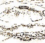 siege